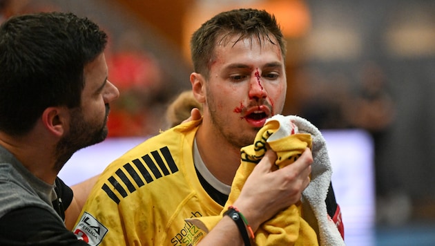 Das Horror-Foul an Bregenz-Handballer Markus Mahr (Bild), der sich einen offenen Nasenbeinbruch zuzog, hat weitreichende Konsequenzen. (Bild: GEPA)