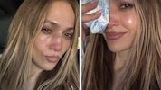 Jennifer Lopez nach dem Unfall – mit Eisbeutel auf der Nase. Die Verletzung musste genäht ...