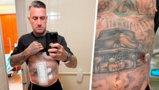 Carey Hart, der Ehemann von Sängerin Pink, hatte einen schlimmen Trainingsunfall. 