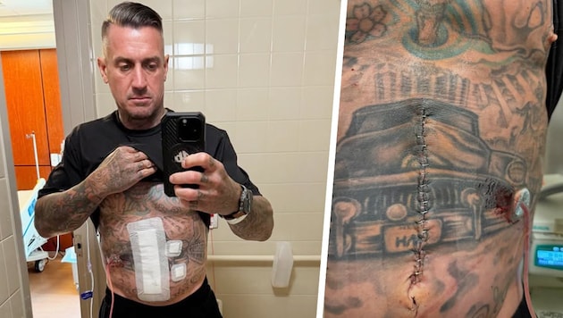 Carey Hart, der Ehemann von Sängerin Pink, hatte einen schlimmen Trainingsunfall. 
