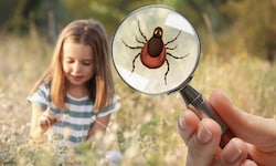 Sie warten im langen Gras, in Büschen und am Boden: Nach jedem Besuch in der Natur sollten Sie ...