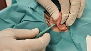 Aus dem Ohr wird das Gewebe entfernt und für das kranke Gelenk aufbereitet.