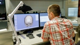 Bei diesem Patienten muss ein Defekt am Hinterhaupt repariert werden: In einer eigenen Software wird das Implantat am PC modelliert. (Bild: Markus Tschepp)