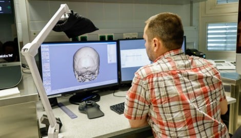 Bei diesem Patienten muss ein Defekt am Hinterhaupt repariert werden: In einer eigenen Software wird das Implantat am PC modelliert. (Bild: Markus Tschepp)