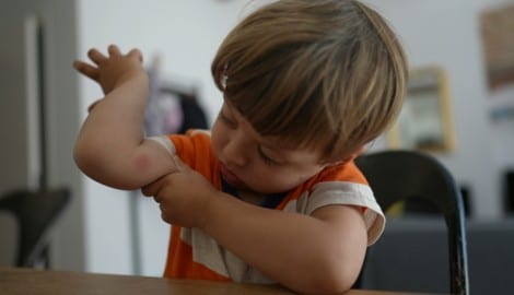 Die Gelse sticht zu: „Mama, ich hab da ein Aua.“