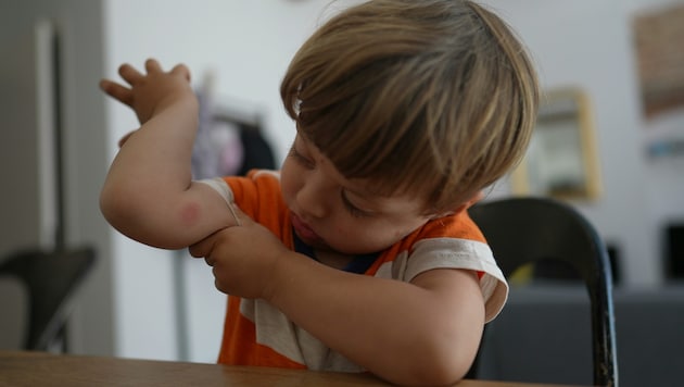 Die Gelse sticht zu: „Mama, ich hab da ein Aua.“