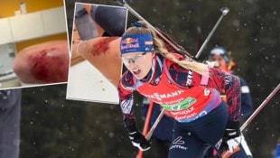 Anna Gandler kam bei einem Ausflug mit dem Rad zu Sturz. 
