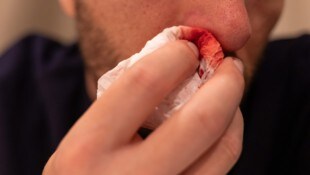 Das Opfer wurde vom Kopfstoß überrascht.