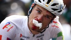 Gleich mehrere Rad-Profis kamen im Schlussteil der dritten Etappe der Tour de France 2025 zu ...