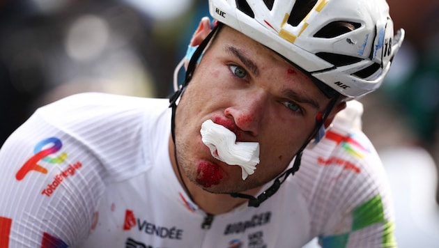 Gleich mehrere Rad-Profis kamen im Schlussteil der dritten Etappe der Tour de France 2025 zu ...