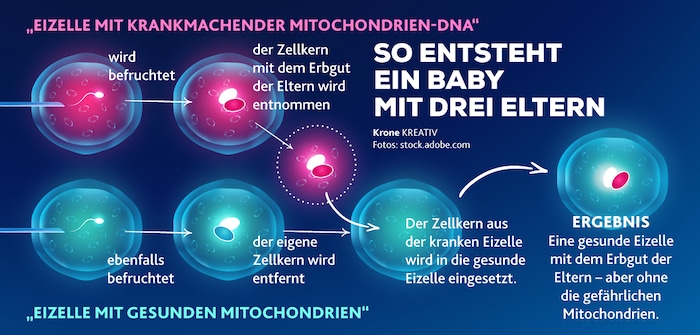 So funktioniert das Baby aus drei Genen: Erbgut der Eltern wird in eine gesunde Spender-Eizelle ...