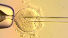Hier wird das Erbgut der Mutter in eine gesunde Spender-Eizelle übertragen. So entsteht ein Baby ...