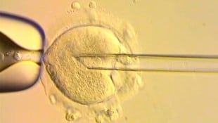Hier wird das Erbgut der Mutter in eine gesunde Spender-Eizelle übertragen. So entsteht ein Baby ...