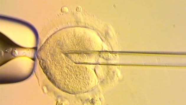 Hier wird das Erbgut der Mutter in eine gesunde Spender-Eizelle übertragen. So entsteht ein Baby ...