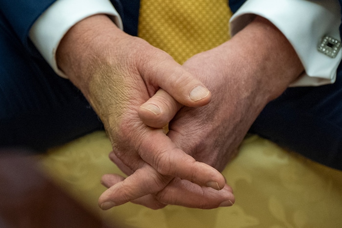 Flecken auf der rechten Hand ...