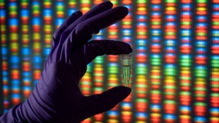 Drei Patienten sind im Rahmen von klinischen Studien in den USA gestorben.