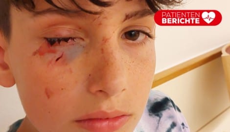 Kurz nach Sebastians Unfall sah sein Gesicht so aus.