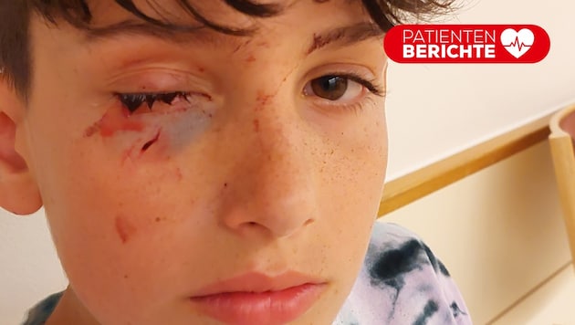 Kurz nach Sebastians Unfall sah sein Gesicht so aus.