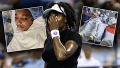 Tennis-Legende Venus Williams äußerte sich via Instagram zu einem heiklen Eingriff.