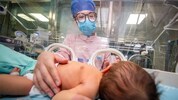 Ob das Baby Folgschäden davontragen wird, steht noch nicht fest. (Symbolbild)