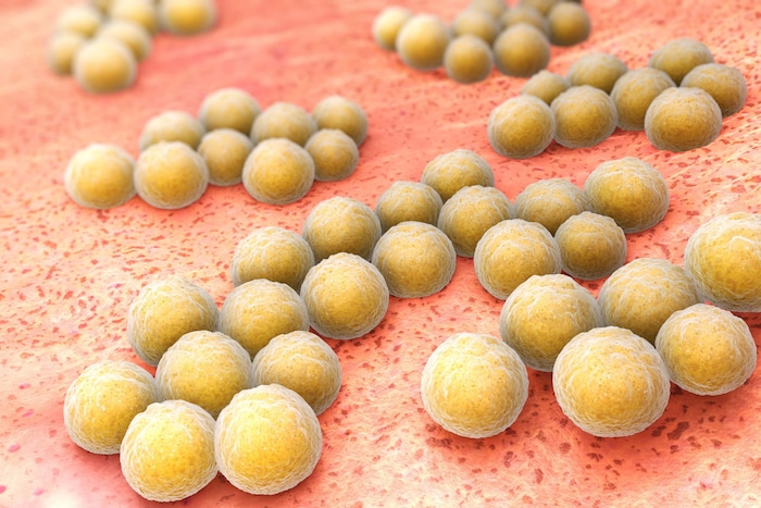 Staphylococcus aureus kann Krankheiten wie Lungenentzündung, Hirnhautentzündung oder Sepsis ...