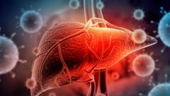 Hepatitis wird oft unterschätzt. Unbehandelt kann die Lebererkrankung jedoch schwerwiegende ...