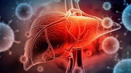 Hepatitis wird oft unterschätzt. Unbehandelt kann die Lebererkrankung jedoch schwerwiegende ...