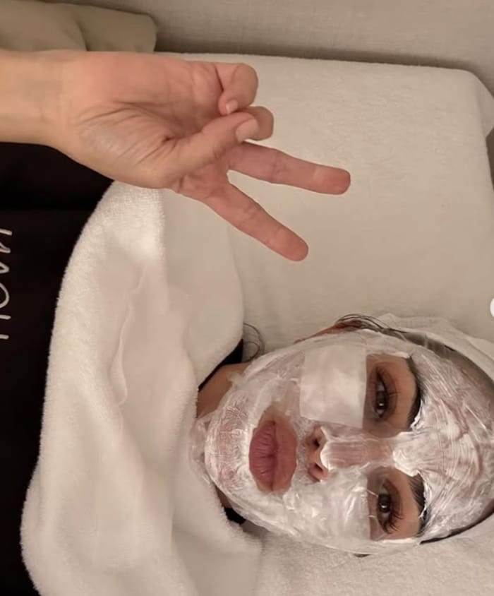 Kim Kardashian probiert lieben gerne neue Beauty-Treatments aus – und schreckt vor kaum etwas ...