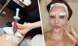Was lässt Kim Kardashian sich da spritzen? Ihre Fans rätseln, genau wie über die Pflaster auf ...
