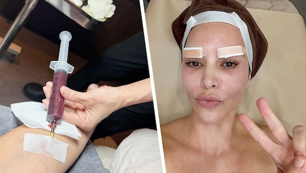 Was lässt Kim Kardashian sich da spritzen? Ihre Fans rätseln, genau wie über die Pflaster auf ...