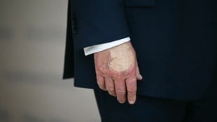 Über den Gesundheitszustand des US-Präsidenten wird immer wieder gemutmaßt.