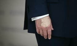 Über den Gesundheitszustand des US-Präsidenten wird immer wieder gemutmaßt.