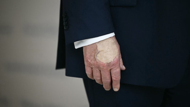 Über den Gesundheitszustand des US-Präsidenten wird immer wieder gemutmaßt.