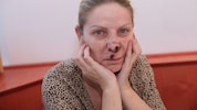 Snezana T. (50) leidet drei Jahre danach noch immer unter den Folgen einer verpfuschten OP – und ...