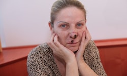 Snezana T. (50) leidet drei Jahre danach noch immer unter den Folgen einer verpfuschten OP – und ...