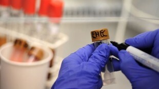 Die Ursache des EHEC-Ausbruchs ist weiterhin unklar.