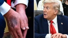 Zu fester Händedruck oder steckt mehr dahinter? Rund um den Gesundheitszustand von US-Präsident ...