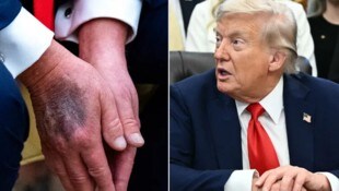 Zu fester Händedruck oder steckt mehr dahinter? Rund um den Gesundheitszustand von US-Präsident ...
