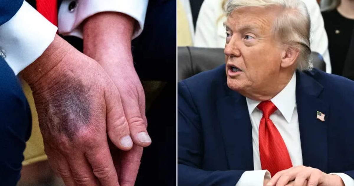 expertin-analysiert-ger-chtek-che-so-krank-ist-donald-trump-wirklich