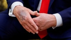 Der US-amerikanische Präsident unterzog sich ungewöhnlich früh seinem zweiten Gesundheitscheck.