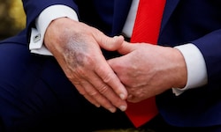 Der US-amerikanische Präsident unterzog sich ungewöhnlich früh seinem zweiten Gesundheitscheck.