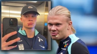 Erling Haaland erschien mit dicker Lippe im Training.