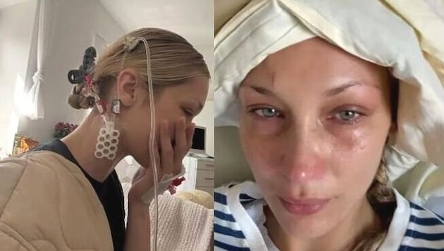 Bella Hadid zeigt sich ungeschminkt, verweifelt und leidend auf ihren neuen Fotos.
