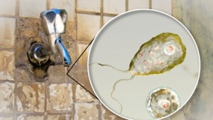 Die Amöbe Naegleria fowleri gelangt durch verunreinigtes Wasser in den menschlichen Körper. Sie ...