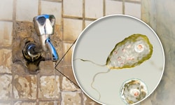Die Amöbe Naegleria fowleri gelangt durch verunreinigtes Wasser in den menschlichen Körper. Sie ...