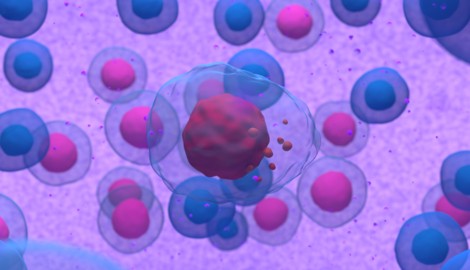 Bösartige Antikörper produzierende Zellen vermehren sich beim Multiplen Myelom, kurz MM genannt, ...