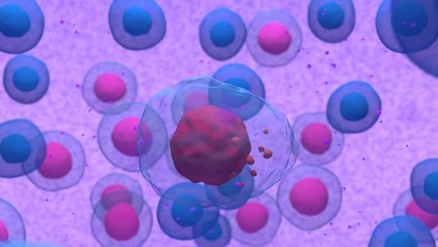 Bösartige Antikörper produzierende Zellen vermehren sich beim Multiplen Myelom, kurz MM genannt, ...