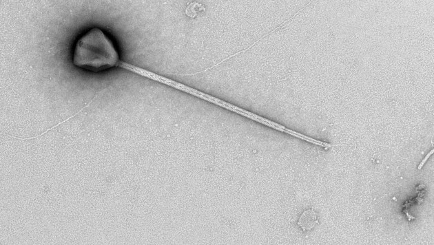Das kürzlich entdeckte Riesenvirus PelV-1 hat einen Schwanz von beispielloser Länge.