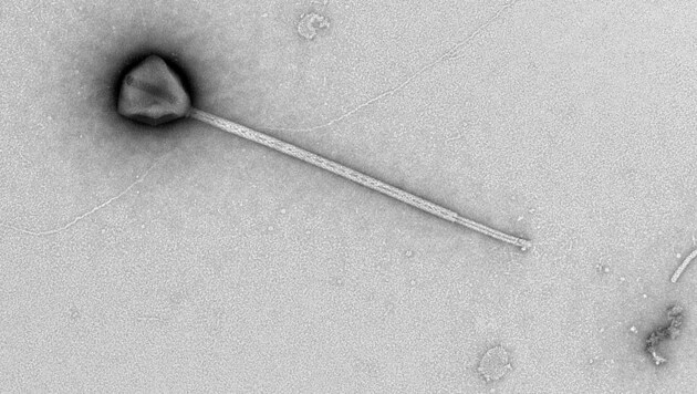 Das kürzlich entdeckte Riesenvirus PelV-1 hat einen Schwanz von beispielloser Länge.