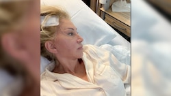 Nach der OP meldete sich Carmen Geiss mit guten Nachrichten bei ihren Fans: Der Eingriff sei ...